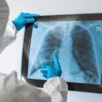 płuca - z której strony bolą