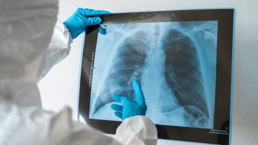 płuca - z której strony bolą