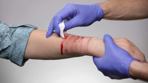 samookaleczanie się