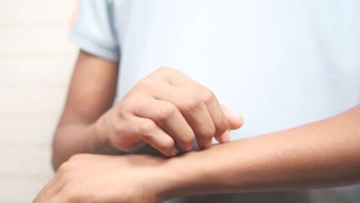 swędzenie skóry po wypiciu kawy