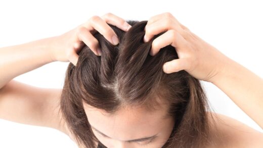 swędzenie skóry głowy