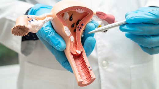 wkładka domaciczna zalety wady czy warto